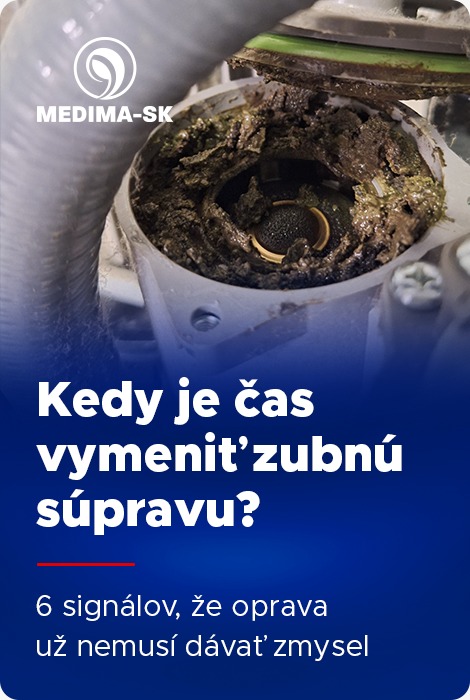 Kedy vymeniť zubnú súpravu Kedy vymeniť zubnú súpravu