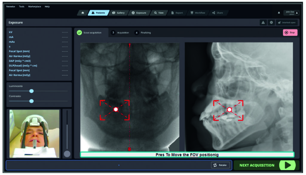 MyRay ProXIma X6 MultiFOV