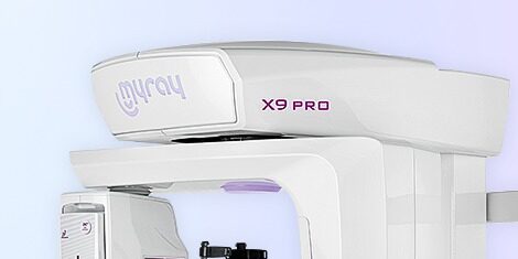 CBCT v stomatológii CBCT v stomatológii