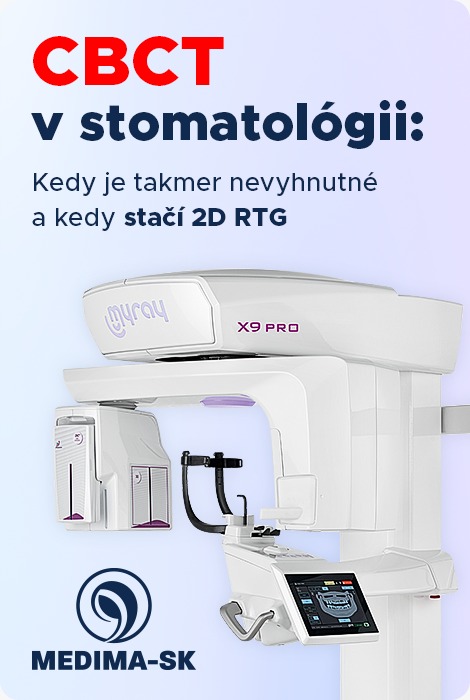 CBCT v stomatológii CBCT v stomatológii