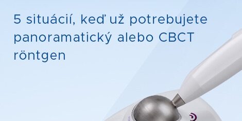 Kedy intraorálny RTG nestačí