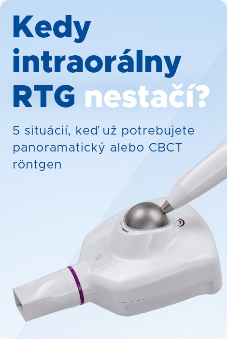 Kedy intraorálny RTG nestačí
